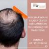 Photo for Hair patch in Delhi