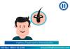 Photo for Hair loss Homeopathic Treatment In Chennai