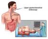 Photo for Endoscopy Test Cost In Kolkata, Specialist Doctors | Credihealth