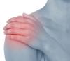 Photo for Rotator Cuff Tendonitis and Bursitis