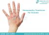 Photo for Best Homeopathy Treatment For Eczema