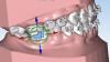 Photo for Digital Orthodontics Market is expected to grow at CAGR of 18% and to reach a revenue of $6.20 Billion by 2023.