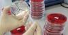 Photo for Infectious Disease Diagnostics Market - Size, Share, Trends, and Forecast to 2026