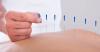Photo for Fibromyalgia Treatment Market To Be At Forefront By 2026