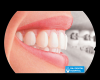 Photo for Get the perfect smile with the help of orthodontist specialist