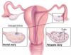 Photo for Polycystic Ovarian Syndrome Treatment Market Research Report 2026: Effect Factors Analysis, Driving Force, Constraints and Threat Prediction