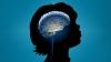 Photo for Autism Disorder Treatment Market - Global Industry Insights, Trends, Outlook, and Opportunity Analysis, 2018-2026