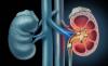 Photo for Urolithiasis Management Devices Market Foresees Skyrocketing Growth in the Coming Years 2018-2026