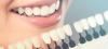 Photo for Cosmetic Dentistry Market - Size, Share, Trends, Outlook, and Opportunity Analysis, 2018-2026