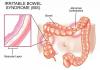 Photo for Global Irritable Bowel Syndrome Treatment Market with present Situation and Forecast To 2026