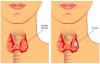 Photo for Best Thyroid Doctor in Kothapet,Dilsukhnagar,Hyderabad,Lb Nagar