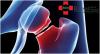 Photo for Orthopaedic Doctor in North West Delhi