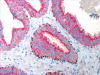 Photo for Dual Specificity Protein Kinase TTK Market - Report 2018-2026 Focuses On Top Companies