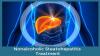 Photo for Nonalcoholic Steatohepatitis Treatment Market – Global Industry Outlook, and  Analysis, 2018-2026