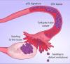 Photo for Fallopian Tube Cancer Market - Size, share, Outlook, and Opportunity Analysis, 2018-2026