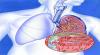 Photo for Respiratory Tract Infection Treatment Market - Size, Share, trends, and Forecast to 2026