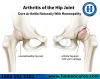 Photo for Best Homeopathy Treatment For Arthritis Problem In HSR Layout