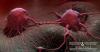 Photo for Rectal Cancer Therapeutics Analysis, Clinical Trials and Developments