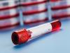 Photo for Blood Collection Tubes Market – Global Industry Insights, Trends, Outlook, and Opportunity Analysis, 2018–2026