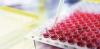 Photo for Cell-Based Assays Market Insights, Share and Future Scope
