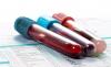 Photo for Hematology Market: Demand Rate with Regional Outlook, Applications, and Forecast 2026