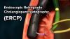 Photo for Cholangiopancreatography Device Market 2018 Global Industry Analysis, Size, Share, Growth, Trends and Forecast 2025