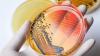 Photo for Enteric Disease Testing Market Forecast to Cross Its Own Peak by 2026