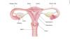 Photo for Find Hysterectomy Cost at Top Hospital in India