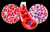 Photo for Leukemia Therapeutics Market - Global Industry Insights, Trends, Outlook, and Opportunity Analysis, 2018-2026