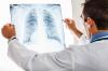 Photo for ALK Positive Lung Cancer Treatment Market - Size, Share, Outlook, and Opportunity Analysis 2018 – 2026