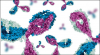 Photo for Bispecific Antibodies Market Growth Opportunities With Leading Players 2026