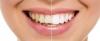 Photo for Cosmetic Dentistry Market An Array Of Graphics And SWOT Analysis of Major Industry Segments