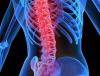 Photo for Spinal Implants Market to 2026- Strategies, Applications and Competitive Landscape