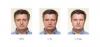 Photo for Top Three Reasons to Undergo Plastic Surgery