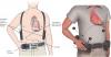 Photo for Cardiac Assist Devices Market Register a Hugh Growth In Healthcare Industry by 2026