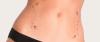 Photo for No.1 Treatment For Liposuction Dubai - Call Now