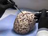 Photo for Brain Only Autopsy