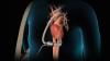 Photo for Ventricular Assist Devices Market Detailed Segmentation, Growth Forecast and Global Key Players Analysis 2026