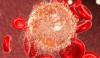 Photo for Acute Lymphoblastic Leukemia Therapeutics Market Key Futuristic Trends And Competitive Landscape 2018-2026