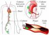 Photo for Coronary Angiography Cost in Bangalore