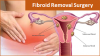 Photo for Plan your Fibroid Treatment in India with Indian Medguru Consultants
