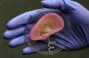Photo for Artificial Kidney Market to Reap Excessive Revenues by 2026