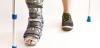 Photo for Global Orthopedic Devices Market Size by Devices, Manufacturers, End User, Region and Forecast 2018 to 2025