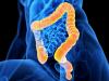 Photo for Short Bowel Syndrome Market Is Expected To Show Significant Growth Over The Forecast Period 2018-2026