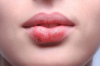 Photo for How to get rid of cold sores fast (overnight)