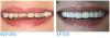Photo for Best Dental Clinic in South Delhi-Smile Makeover