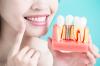 Photo for Global Dental Implants Market Overview, Industry Top Manufactures, Market Size, Industry Growth Analysis and Forecast: 2026