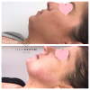 Photo for Facial Sculpting Limited  Chelsea Private Clinic