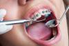 Photo for Dental Braces Market Prognosticated For A Ravishing Growth By 2026