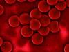 Photo for Sickle Cell Anemia Therapeutics Market is Expected to Gain Popularity Across the Globe by 2026